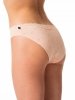 Figi Key LPR 628 A24 A'2 S-XL